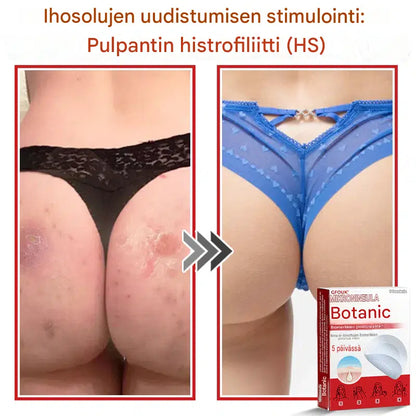 Kasvipohjaiset syylä- ja luomenpoistolaastarit