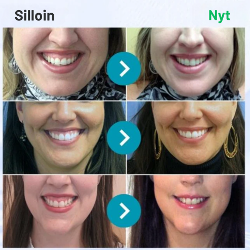 Hormonra® 𝑭𝒐𝒄𝒖𝒔𝒔𝒎𝒊𝒍𝒆 – Mehiläismyrkkyä sisältävä suunhoitojauhe 🦷🦷