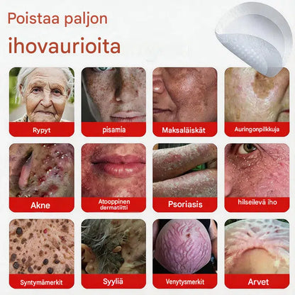 Kasvipohjaiset syylä- ja luomenpoistolaastarit