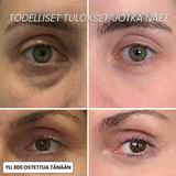 Vähennä Ryppyjä ja Väsymyksen Merkkejä Luonnollisesti