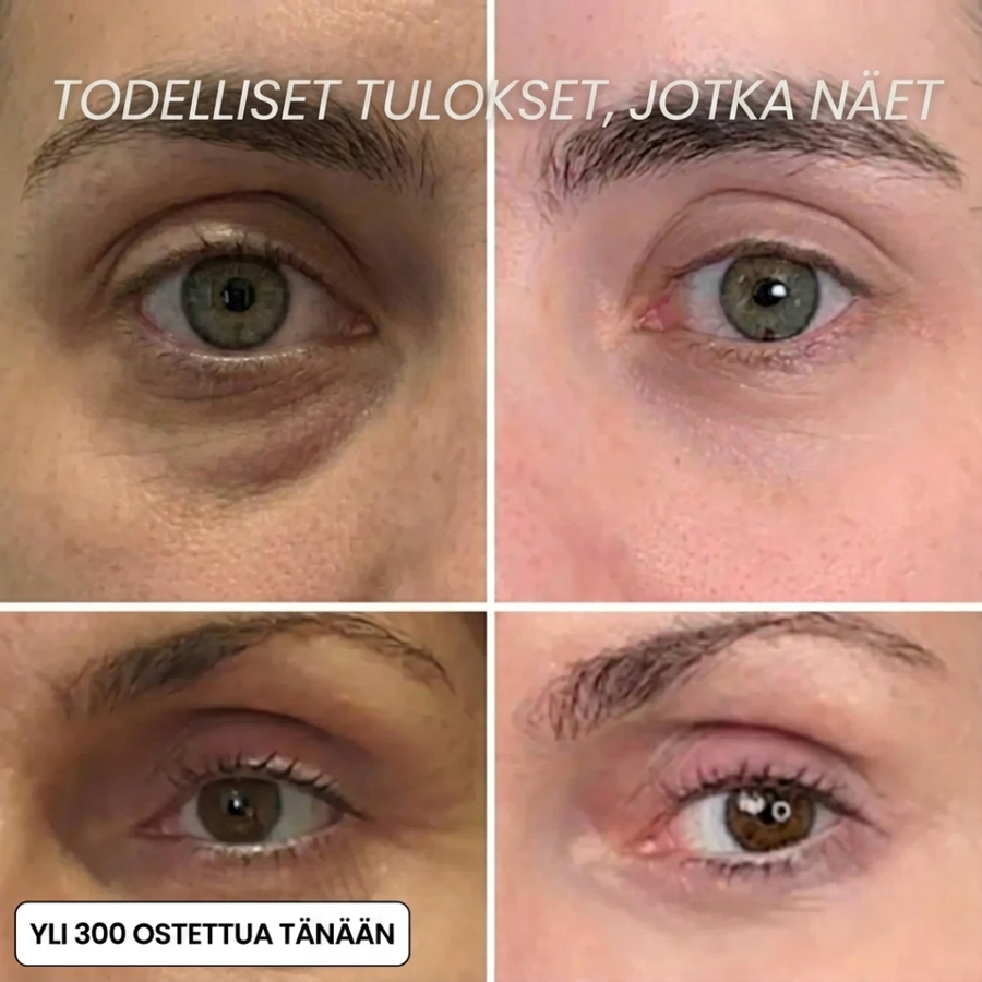 Vähennä Ryppyjä ja Väsymyksen Merkkejä Luonnollisesti