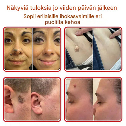 Kasvipohjaiset syylä- ja luomenpoistolaastarit