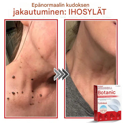 Kasvipohjaiset syylä- ja luomenpoistolaastarit