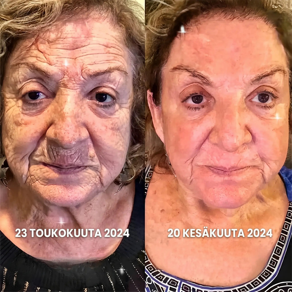 SILOTA SYVÄT RYPYT VAIN 2 MINUUTISSA PÄIVÄSSÄ!