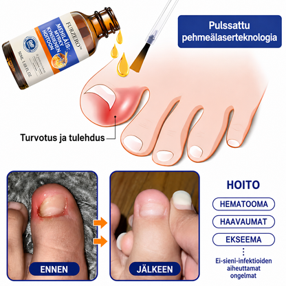 Mehiläisen Myrkky  - Kynsisienilääke: Kattava Ratkaisu Kynsisieniin